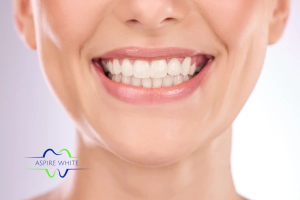 Follow your teeth whitening aftercare Southend-on-Sea to prolong your whiter smile!