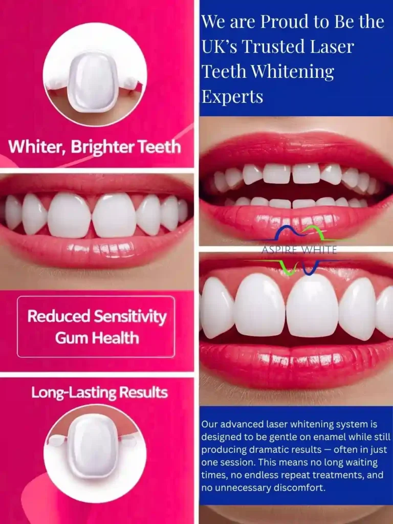 We are Proud to Be the UK’s Trusted Laser Teeth Whitening Experts Southend-on-Sea